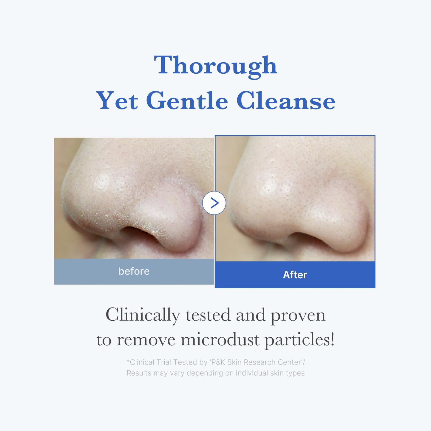 [medicube] Zero Foam Cleanser 120 g