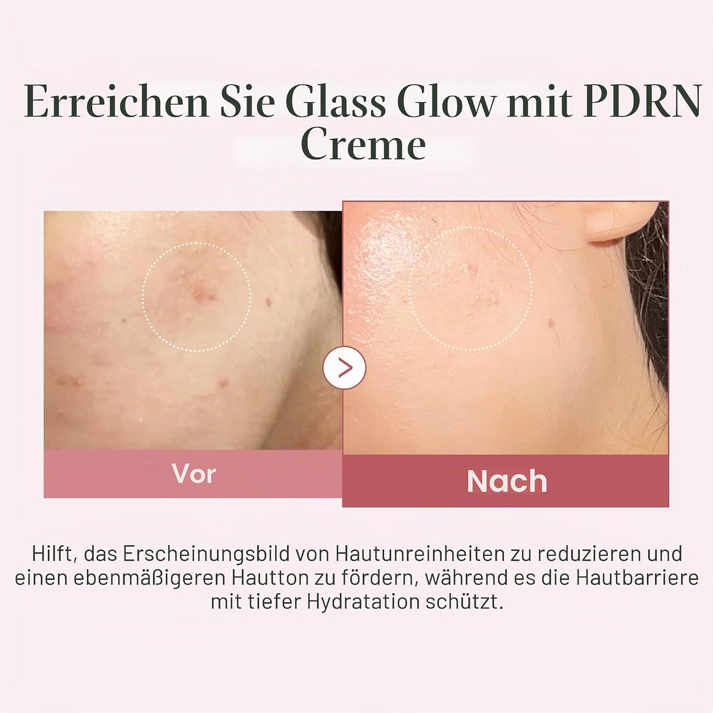 Medicube PDRN Pink Hyaluronic Moisturizing Cream