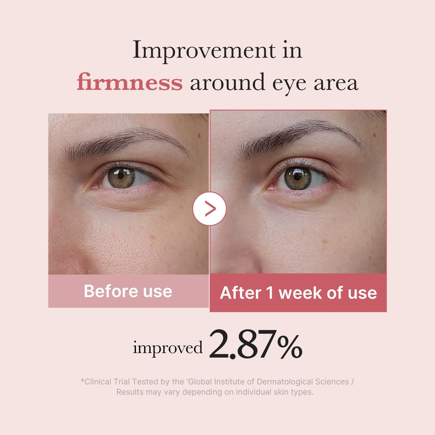 medicube Eye Cream with Sodium DNA PDRN Pink Peptides | 99% Purity Retinol for Fine Lines | PDRN & Niacinamide Eye Serum for Uneven Skin Tone | Korean Skincare, 1.01 fl.oz